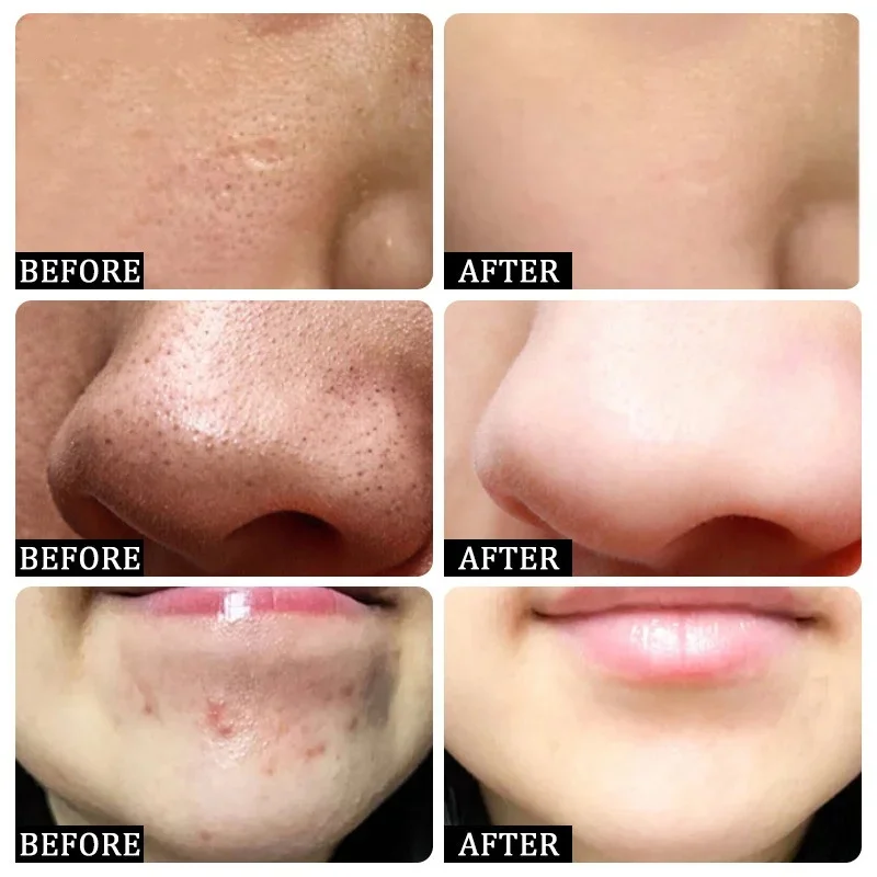 Salicylic Acid Pore Clearing C - Korean Skincare Routine avis et prix