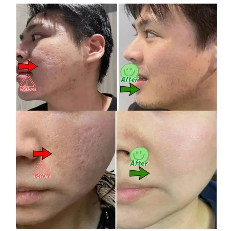 Salicylic Acid Pore Clearing C - Korean Skincare Routine avis et prix