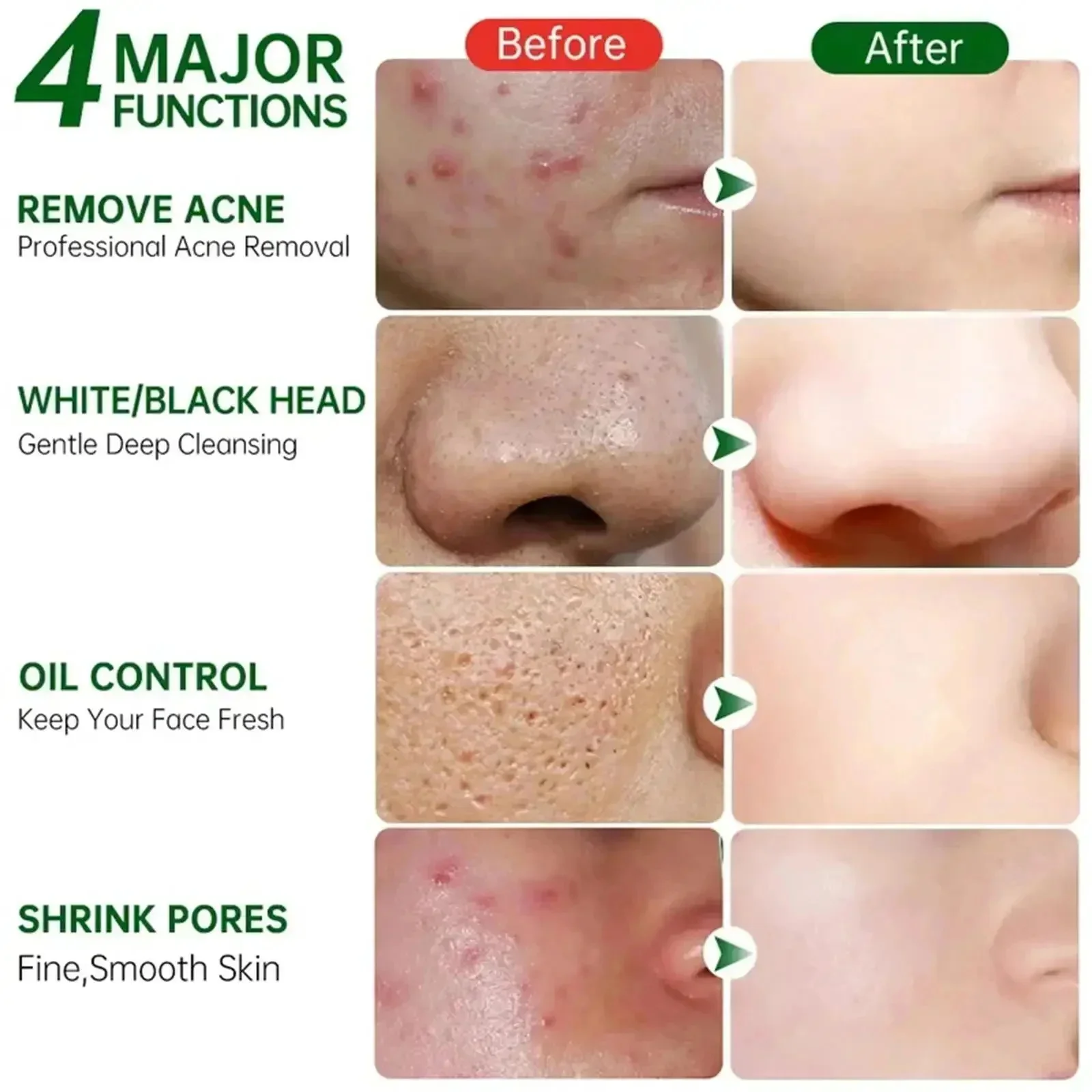 Salicylic Acid Pore Clearing C - Korean Skincare Routine avis et prix