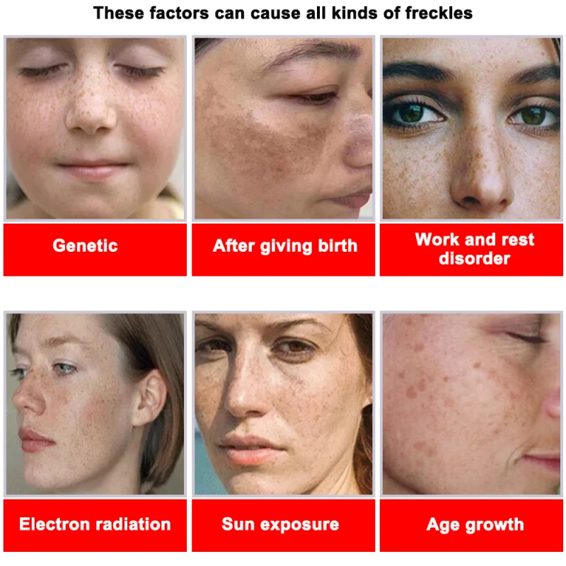 Powerful Spot-removing Whiteni - Korean Skincare Routine avis et prix